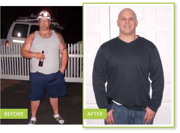 John, a Fit 4 Life patient, before and after photos