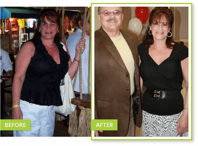 Judy, a Fit 4 Life patient, before and after photos